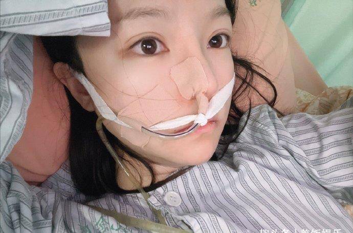 新澳开奖结果历史查询和00后女孩自学插胃管与00后女孩自学插胃管视频