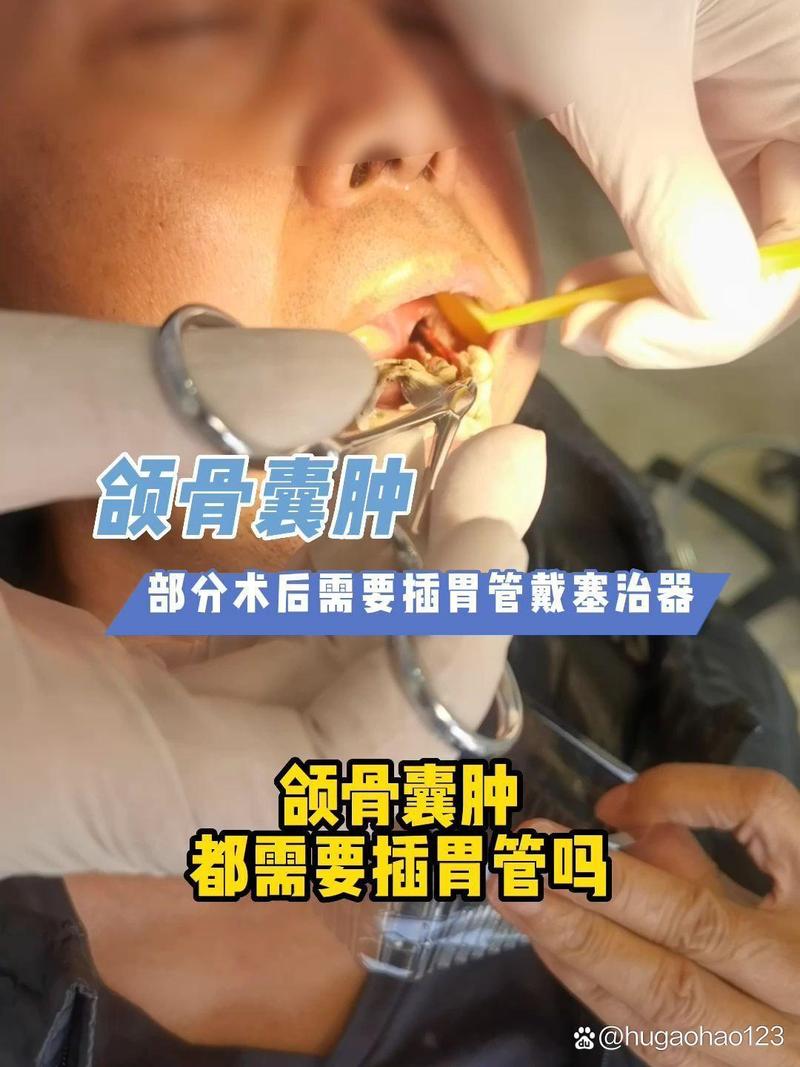 新澳今天晚上9点30分开门吗香港和00后女孩自学插胃管与00后女孩自学插胃管视频